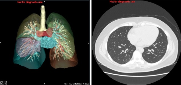 tokyo/dock/optional/image/2025CT2