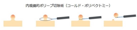 内視鏡による検査部位