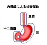 内視鏡による検査部位