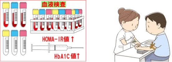 採血イラスト