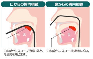 内視鏡による検査部位