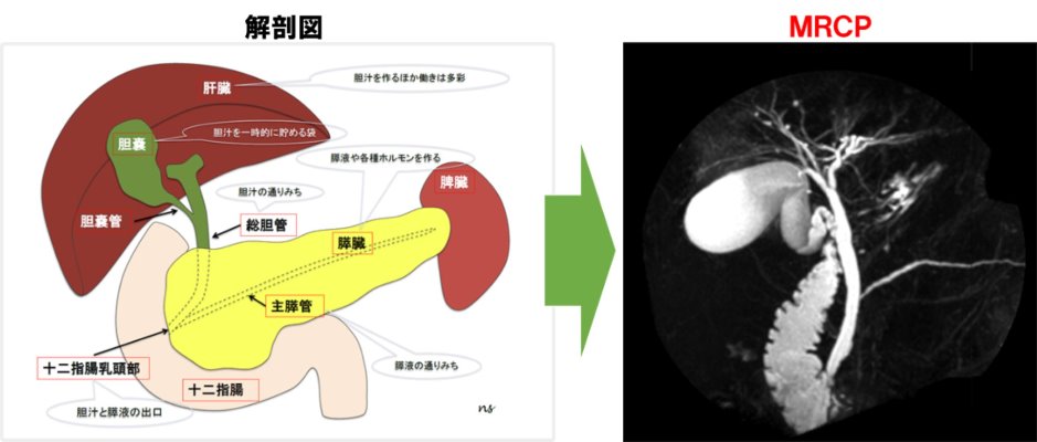 解剖図とMRCP画像