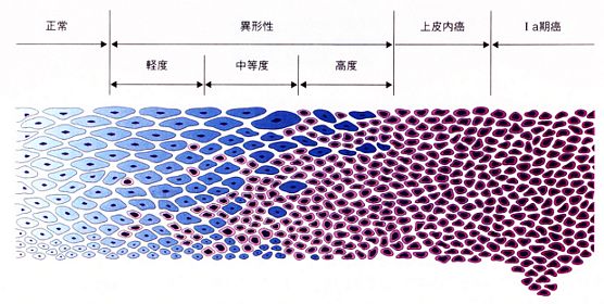 子宮頚部扁平上皮の組織模式図