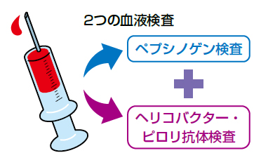 2つの血液検査　ペプシノゲン検査+ヘリコバクター・ピロリ抗体検査