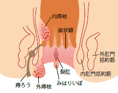 症状