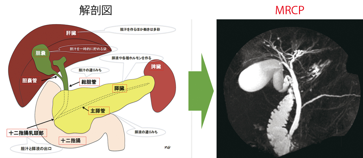 解剖図 MRCP