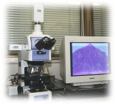 顕微鏡とモニター装置