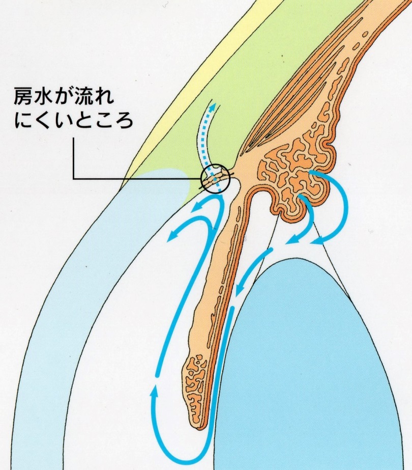 図3a 開放隅角