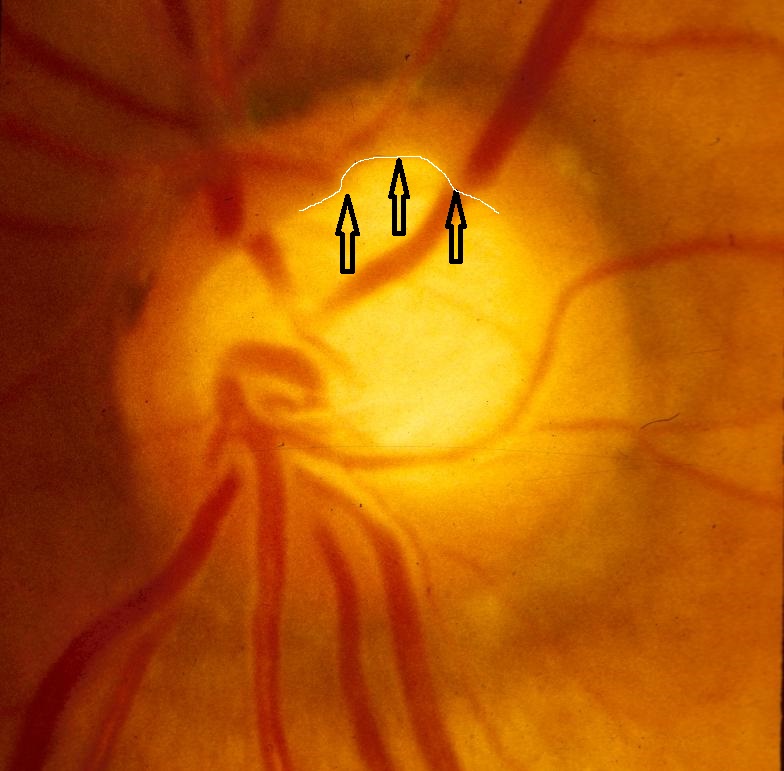図7=眼底検査