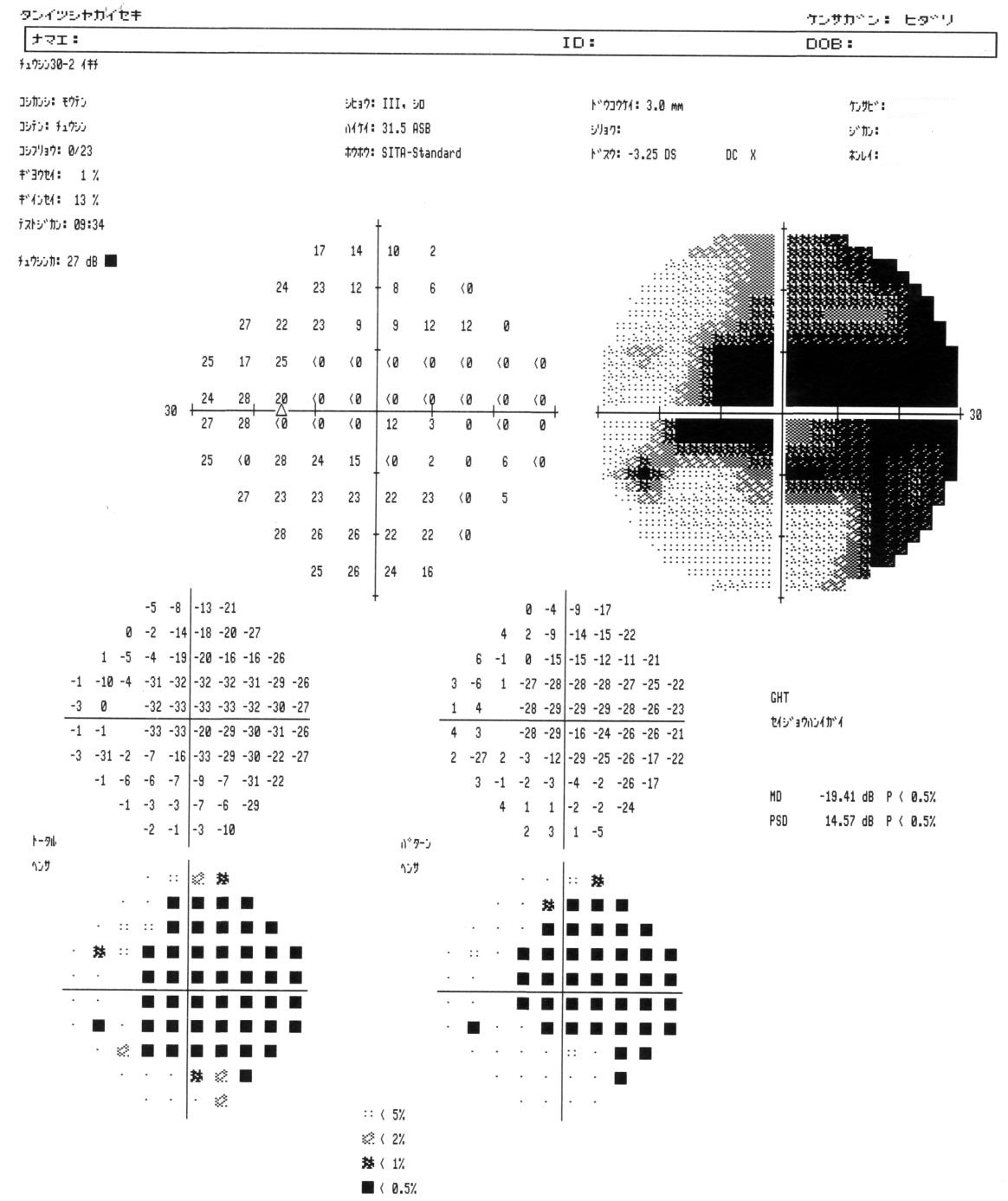 図8b=視野検査結果