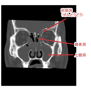 前から見た図。