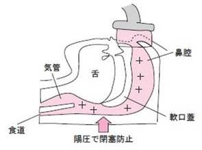 図4 CPAP療法の原理