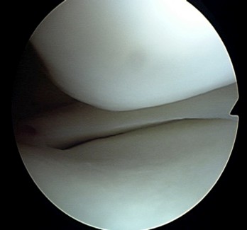 図6-2
