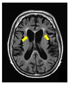 図1 MRI画像