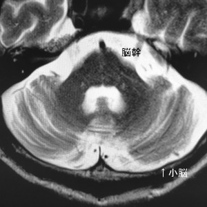 図2 MRI画像